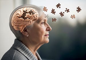 h k alzheimer