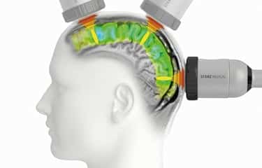 TPS Alzheimer Therapie Behandlung